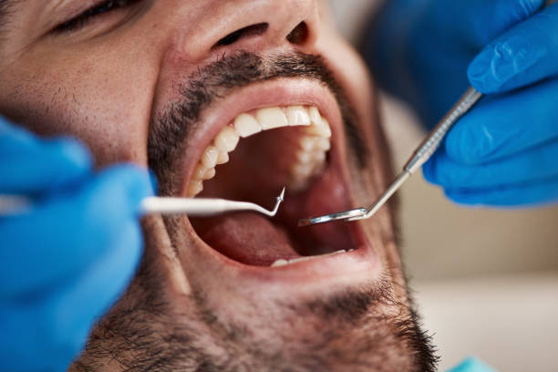 Best Cosmetic Emergency Dentistry in Groveville, NJ
